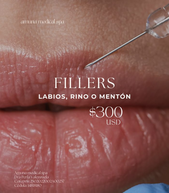 SnapInsta.to_574048860_17966835002977495_7547594941923506672_n